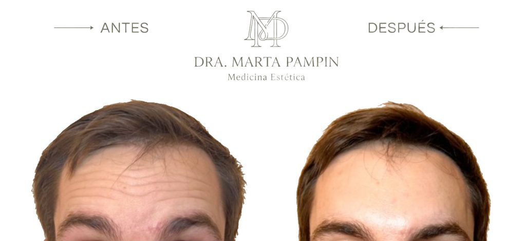 Antes y después, Dra. Marta Pampín
