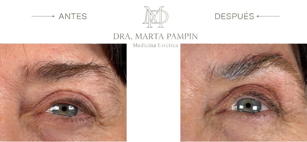 Antes y después, Dra. Marta Pampín
