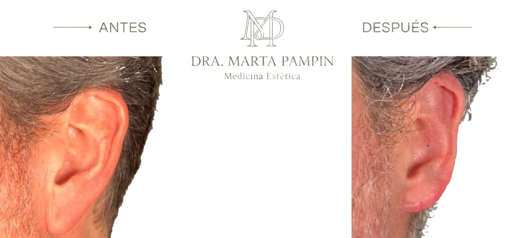 Antes y después, Dra. Marta Pampín